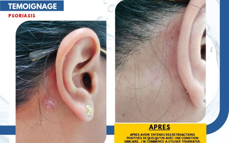 TeraWater Testimonial (4)